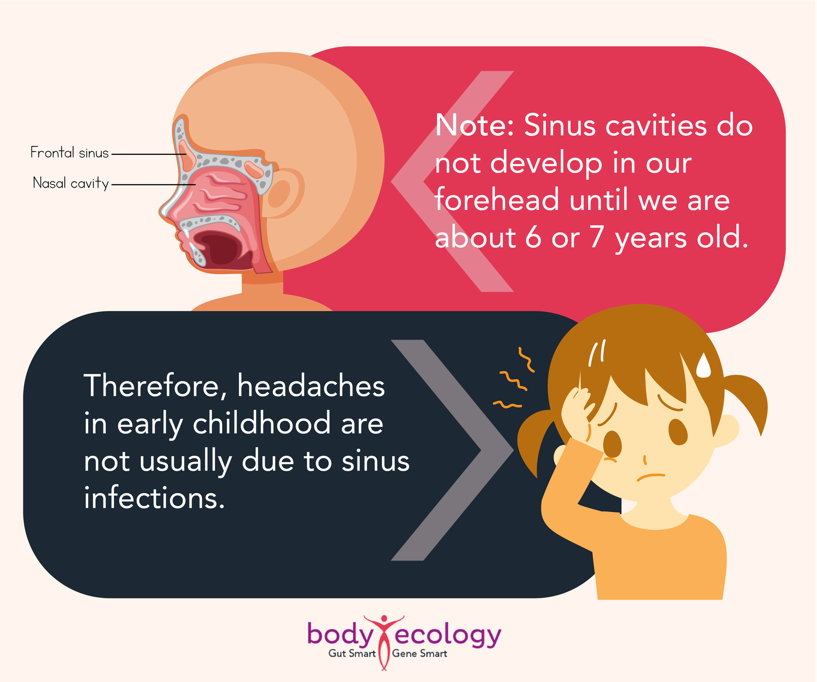sinusitis