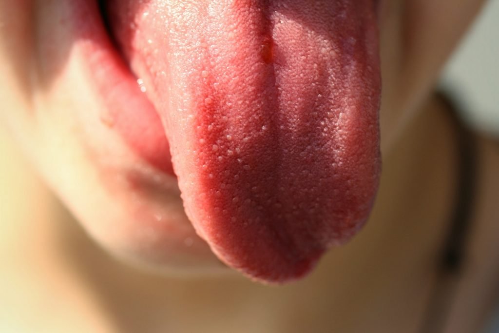 white stuff on tongue